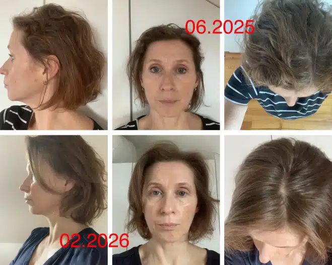 avant après masse et volume cheveux fins -